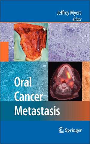 Oral Cancer Metastasis de Jeffrey Myers