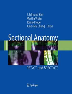 Sectional Anatomy: PET/CT and SPECT/CT de E. Edmund Kim