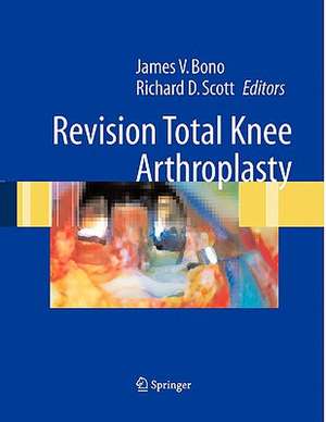 Revision Total Knee Arthroplasty de James V. Bono