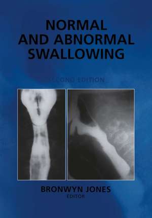 Normal and Abnormal Swallowing: Imaging in Diagnosis and Therapy de Bronwyn Jones