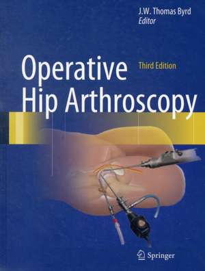 Operative Hip Arthroscopy de J.W. Thomas Byrd