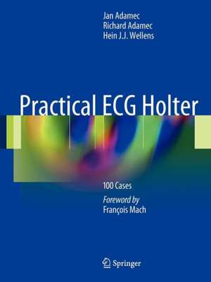 Practical ECG Holter: 100 Cases de Jan Adamec