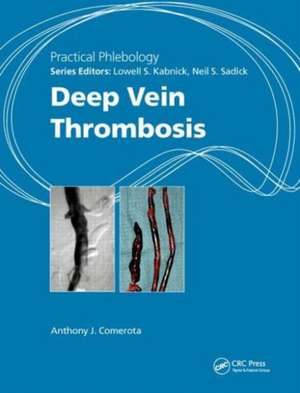 Practical Phlebology: Deep Vein Thrombosis de Anthony J. Comerota