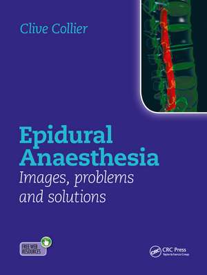 Epidural Anaesthesia: Images, Problems and Solutions de Clive Collier