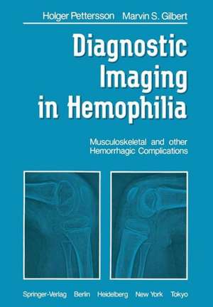 Diagnostic Imaging in Hemophilia: Musculoskeletal and Other Hemorrhagic Complications de H. Pettersson