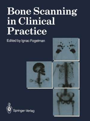 Bone Scanning in Clinical Practice de Ignac Fogelman