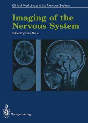 Imaging of the Nervous System de Paul Butler