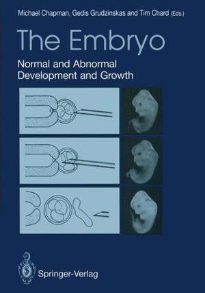 The Embryo: Normal and Abnormal Development and Growth de Michael G. Chapman