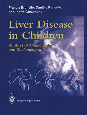 Liver Disease in Children: An Atlas of Angiography and Cholangiography de Francis Brunelle