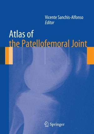 Atlas of the Patellofemoral Joint de Vicente Sanchis-Alfonso