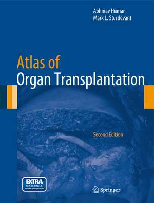 Atlas of Organ Transplantation de Abhinav Humar