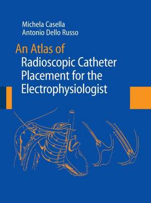 An Atlas of Radioscopic Catheter Placement for the Electrophysiologist de Michela Casella