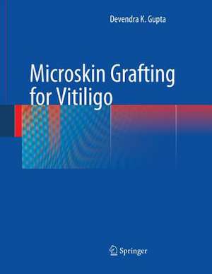 Microskin Grafting for Vitiligo de Devendra K. Gupta