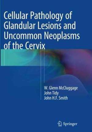 Cellular Pathology of Glandular Lesions and Uncommon Neoplasms of the Cervix de W. Glenn McCluggage