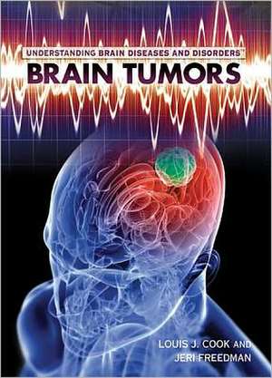 Brain Tumors de Louis J. Cook