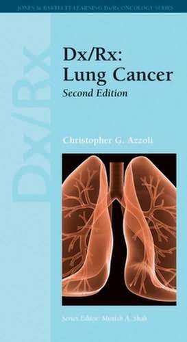 DX/RX: Lung Cancer de Azzoli