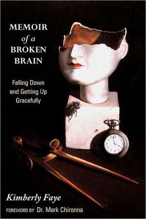 Memoir of a Broken Brain de Kimberly Faye