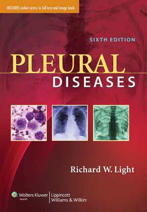 Pleural Diseases de Richard W. Light MD