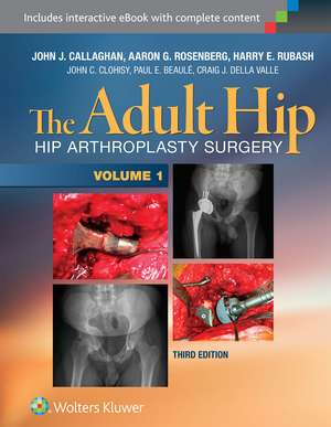 The Adult Hip (Two Volume Set): Hip Arthroplasty Surgery de Dr. John J. Callaghan