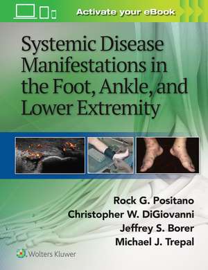 Systemic Disease Manifestations in the Foot, Ankle, and Lower Extremity de Rock G. Positano DPM, MSc, MPH