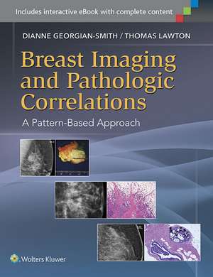 Breast Imaging and Pathologic Correlations: A Pattern-Based Approach de Dianne Georgian-Smith