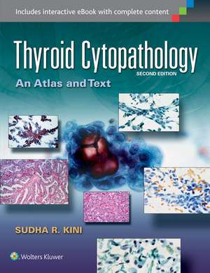 Thyroid Cytopathology: An Atlas and Text de Sudha R. Kini MD