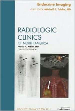 Endocrine Imaging, An Issue of Radiologic Clinics of North America de Mitchell E. Tublin