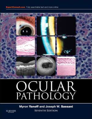 Ocular Pathology de Myron Yanoff