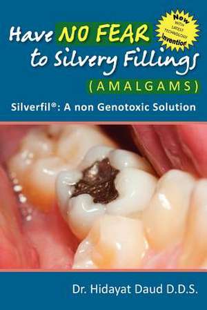 Have No Fear to Silvery Fillings (Amalgams) - Silverfil de Hidayat Daud