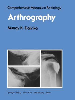 Arthrography de M. K. Dalinka