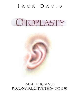 Otoplasty: Aesthetic and Reconstructive Techniques de Jack Davis