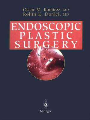 Endoscopic Plastic Surgery de Oscar M. Ramirez