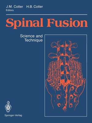 Spinal Fusion: Science and Technique de Jerome M. Cotler