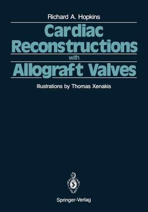 Cardiac Reconstructions with Allograft Valves de V.J. Ferrans