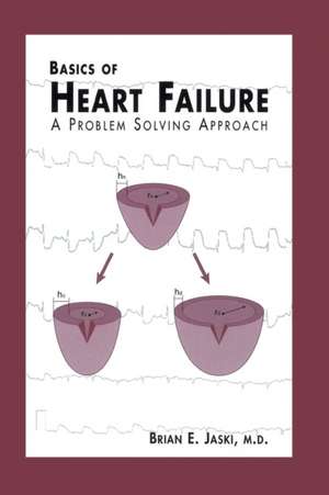 Basics of Heart Failure: A Problem Solving Approach de Brian E. Jaski