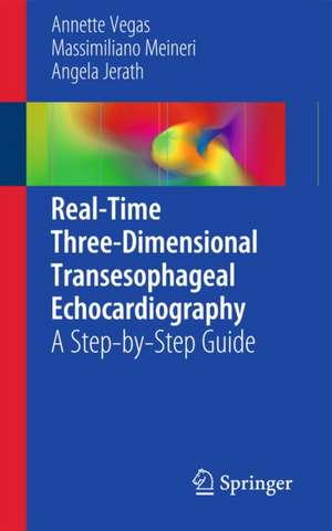 Real-Time Three-Dimensional Transesophageal Echocardiography: A Step-by-Step Guide de Annette Vegas