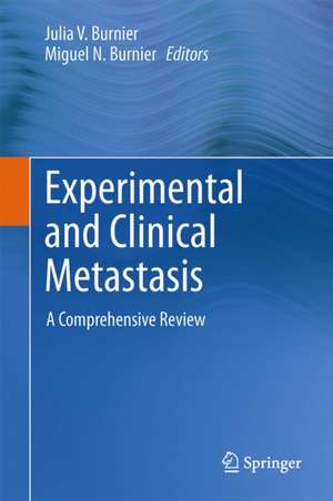 Experimental and Clinical Metastasis: A Comprehensive Review de Julia V. Burnier