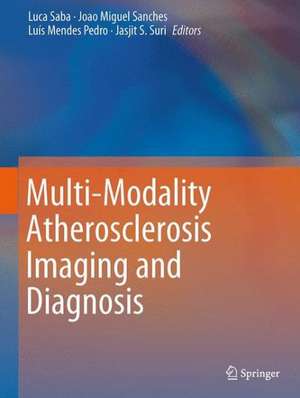 Multi-Modality Atherosclerosis Imaging and Diagnosis de Luca Saba