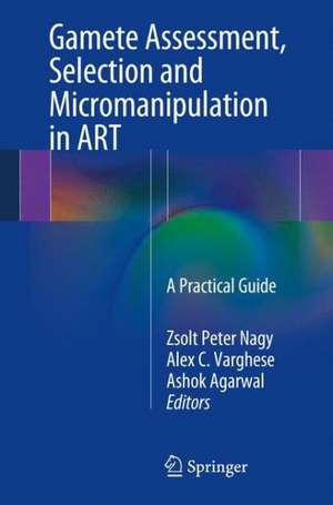 Gamete Assessment, Selection and Micromanipulation in ART: A Practical Guide de Zsolt Peter Nagy