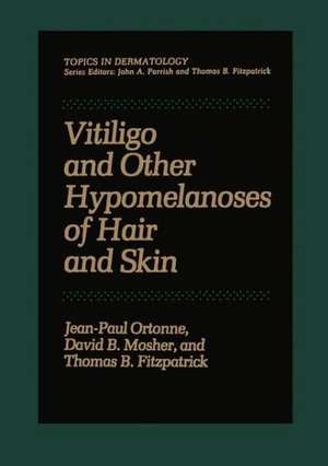 Vitiligo and Other Hypomelanoses of Hair and Skin de Jean-Paul Ortonne