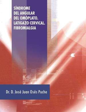 Sindrome del Angular del Omoplato. Latigazo Cervical. Fibromialgia de D. Jose Juan Oses Puche