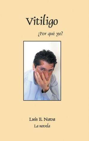 Vitiligo de Luis Enrique Nava Martinez