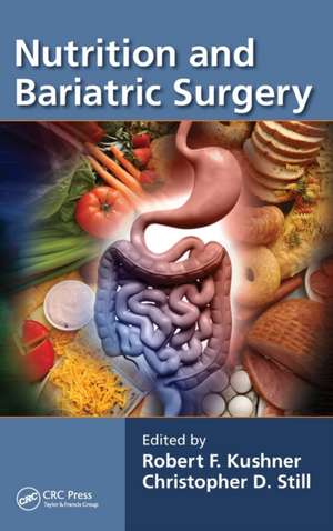 Nutrition and Bariatric Surgery de Robert F. Kushner