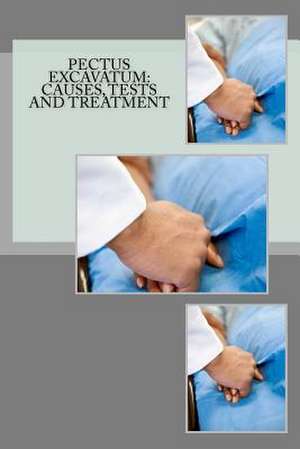 Pectus Excavatum de John Hewitt Ma