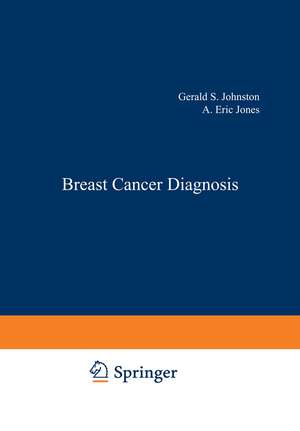 Breast Cancer Diagnosis de Gerald Johnston