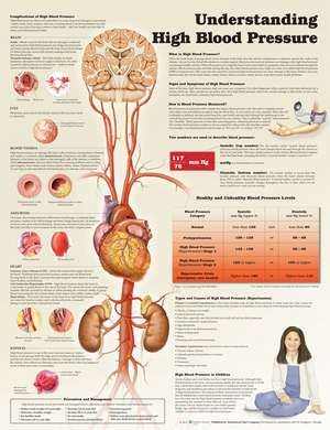 Understanding High Blood Pressure de Anatomical Chart Company