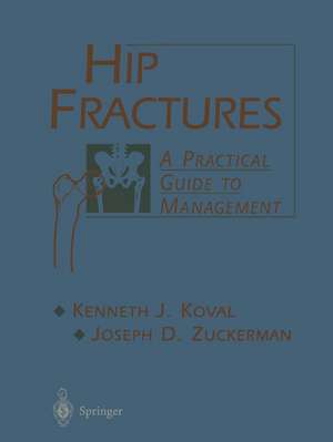 Hip Fractures: A Practical Guide to Management de Kenneth Koval