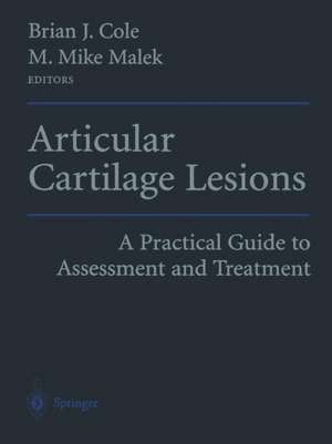 Articular Cartilage Lesions: A Practical Guide to Assessment and Treatment de Brian J. Cole