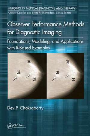 Observer Performance Methods for Diagnostic Imaging: Foundations, Modeling, and Applications with R-Based Examples de Dev P. Chakraborty