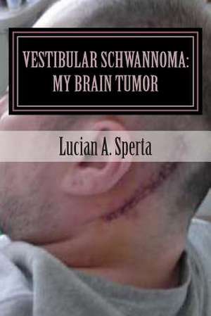 Vestibular Schwannoma de Lucian a. Sperta